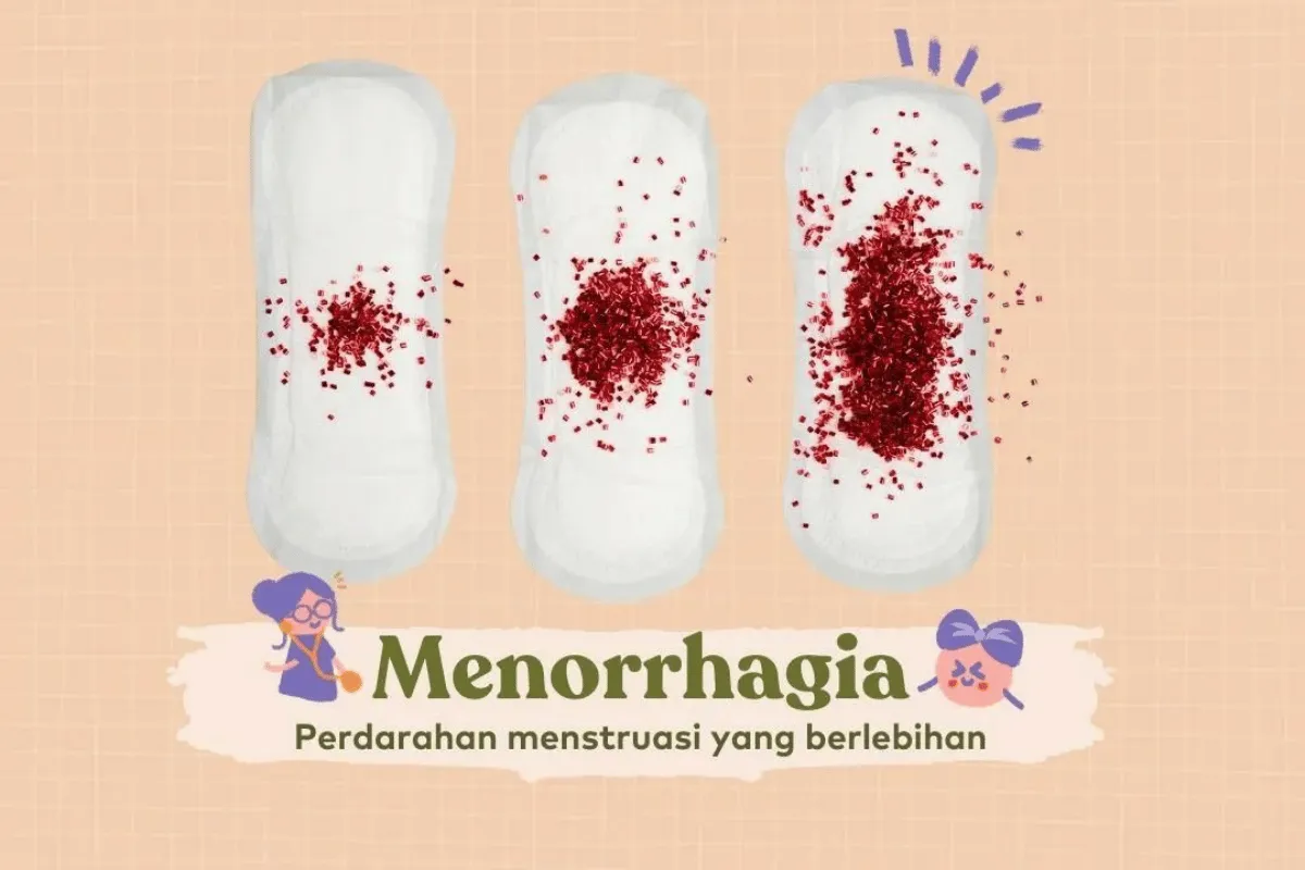 Menstruasi berlebihan