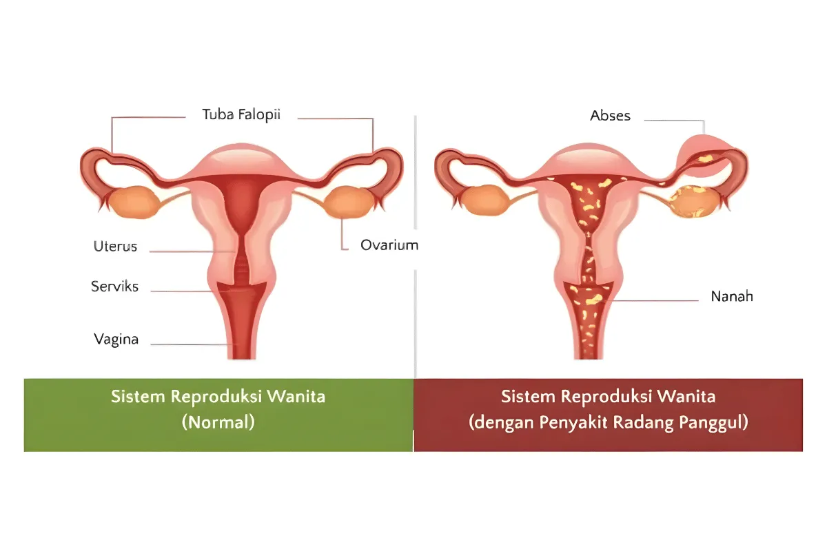 reproduksi wanita. 