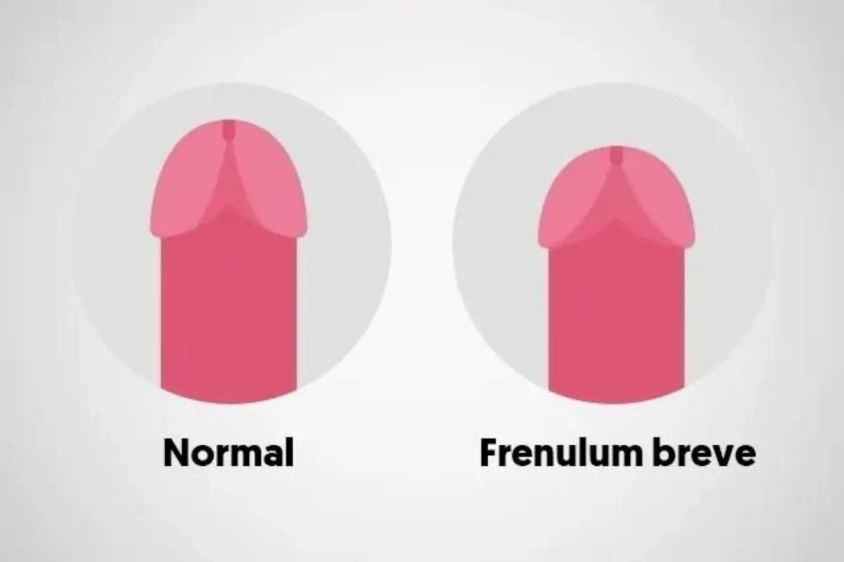 Frenulum. 